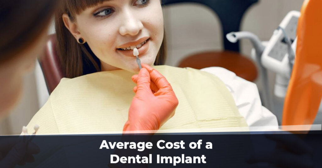 average-cost-of-a-dental-implant-erce-bele-o-lu